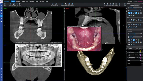 planmeca-romexis-6-2d-3d-images.jpg